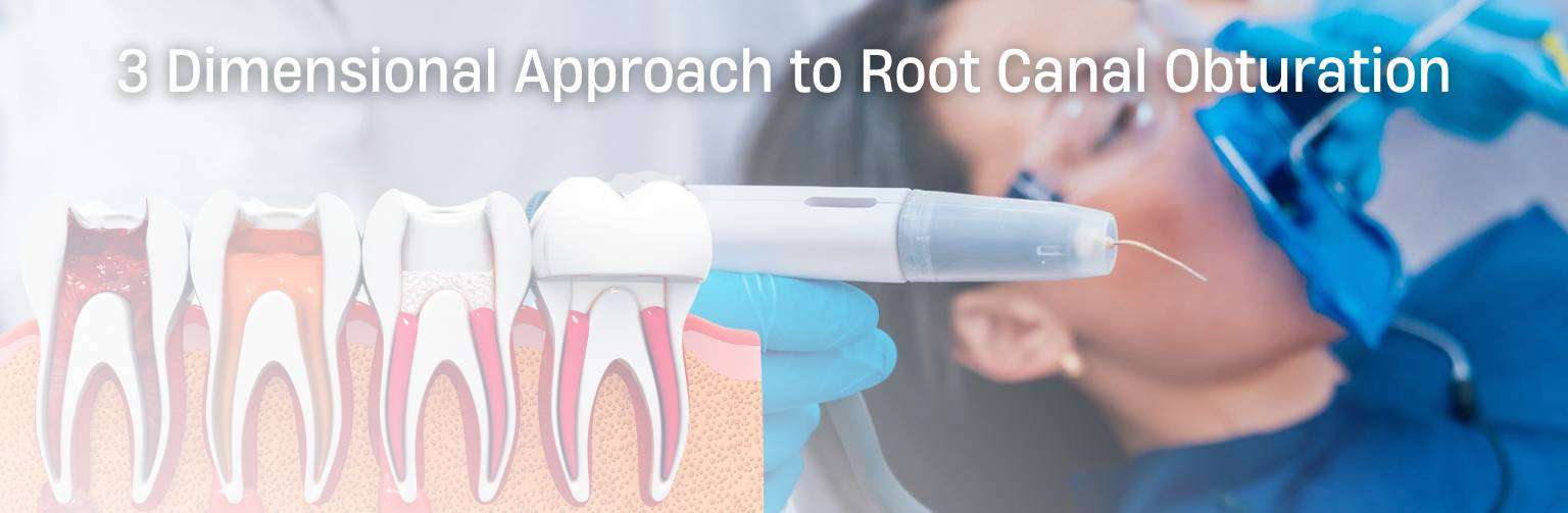 3 Dimensional Approach to Root Canal Obturation