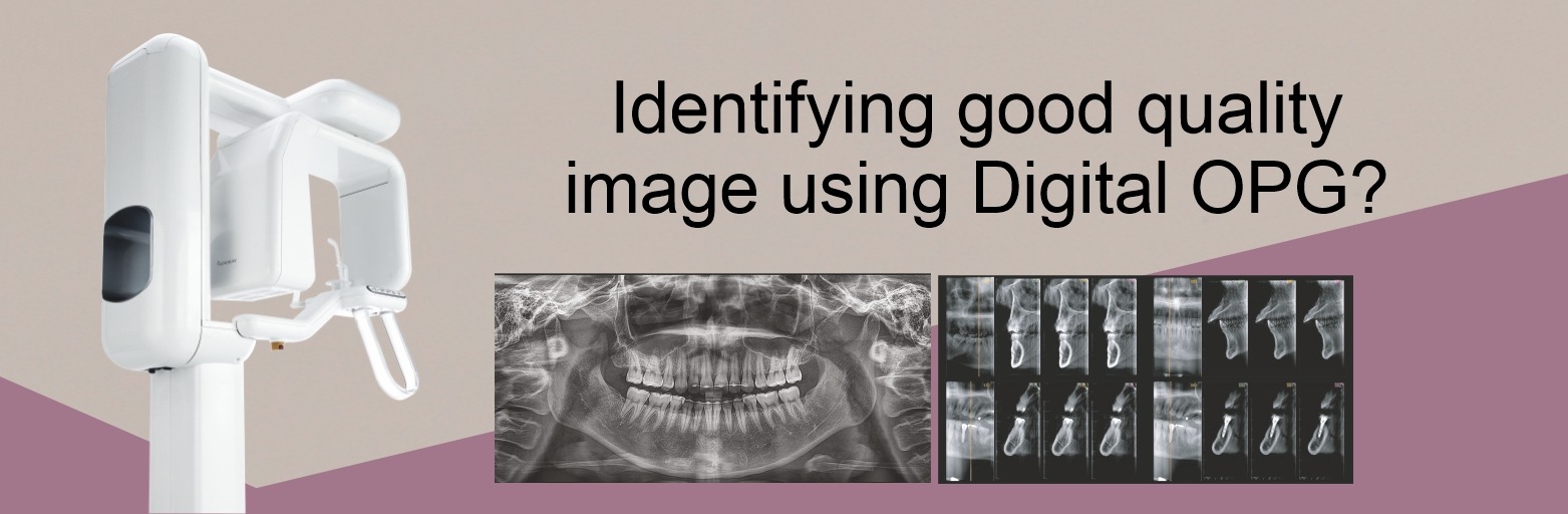 Identifying Good Quality Images Using Digital OPG?