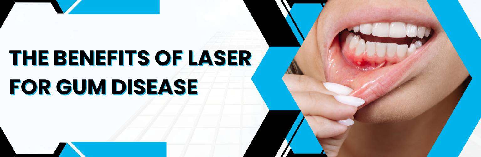 The Benefits of Laser for Gum Disease