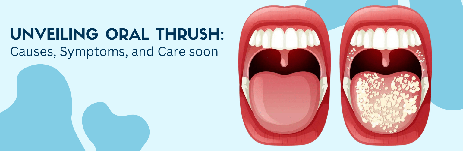 Unveiling Oral Thrush Causes, Symptoms, and Care