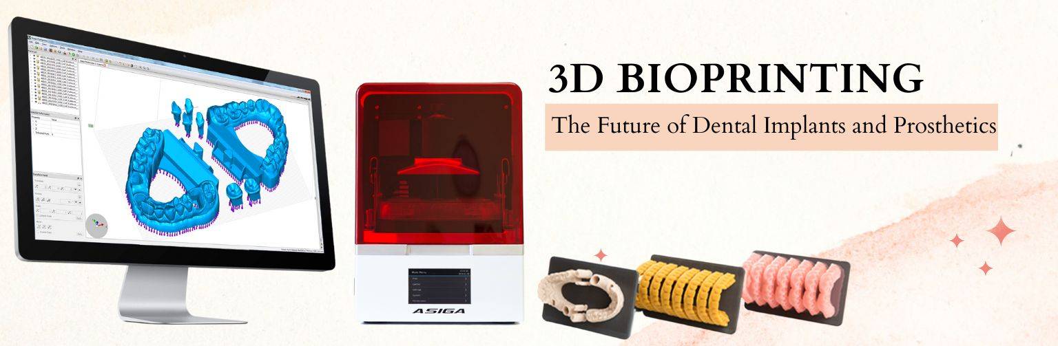 3D Bioprinting – The Future of Dental Implants and Prosthetics