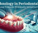 Laser Technology in Periodontal Therapy