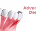 Advancements in Dental Implant Technology
