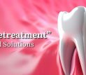 Endodontic Retreatment_blog
