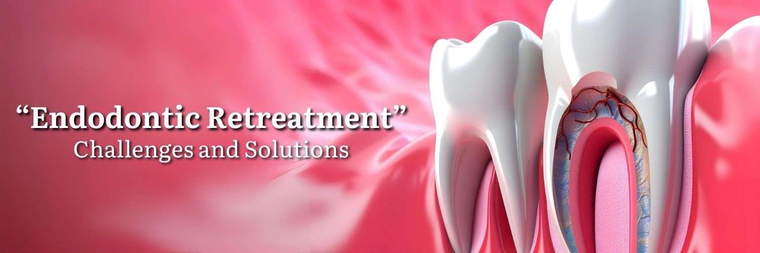 Endodontic Retreatment_blog