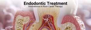 Endodontic Treatment: Innovations in Root Canal Therapy